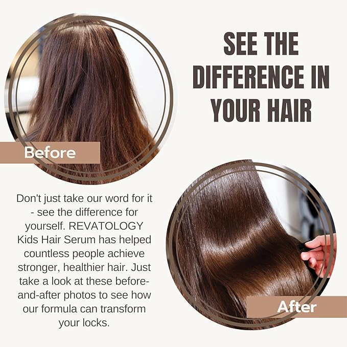 REVATOLOGY Kids Hair Serum (Made in USA) for Hair Thickness, Strength, Growth and Scalp Revitalization for straight, curly, waivy, coiled hair in toddlers, children, adults - chemical & cruelty free