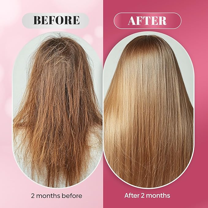 Biotin Gummies- Hair, Skin and Nails Vitamins for Men and Women, Supports Hair Growth and Stronger Nails, Hair Vitamin Gummies, Vitamin B7-60 Gummies