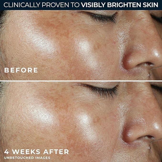 RoC Multi Correxion Revive + Glow Vitamin C Broad Spectrum SPF 30 Moisturizer (1.7 oz) with Retinol Eye Cream Packette