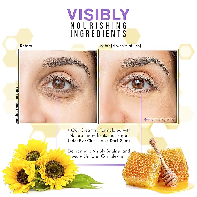 Epic Organic Night Repair | Anti Wrinkle Night Cream for Women | Anti Aging Night Cream with Hyaluronic Acid and Collagen | Night Moisturizer for Face | Day and Night Facial Skin Care | 1.7 oz