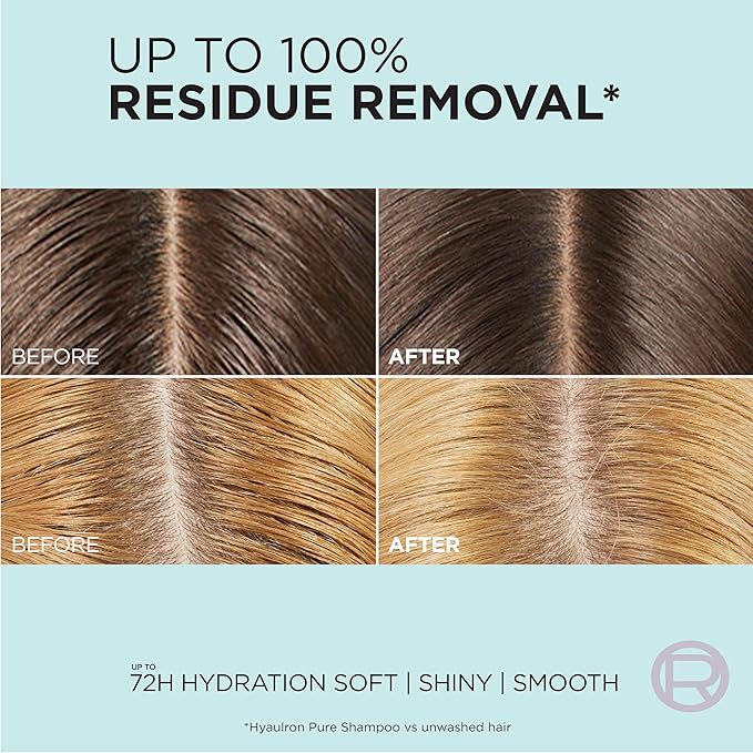 L'Oreal Paris Elvive Hyaluron + Pure Oil Erasing Scalp Serum with Salicylic Acid For Oily Hair, 3.45 Fl Oz