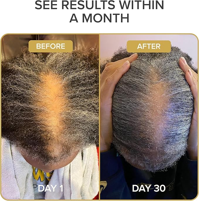 Iconic Natural Hair Vitamins for Fast Hair Growth - Pure Hair Supplements Formulated with Vitamins to Promote Thicker, Stronger Hair - Vegan Hair Care for Hair Loss - Non-GMO (60 Capsules)